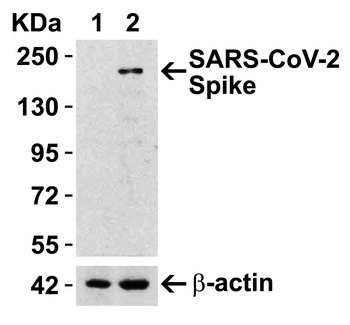 SARS-CoV-2 (COVID-19) Spike RBD Antibody