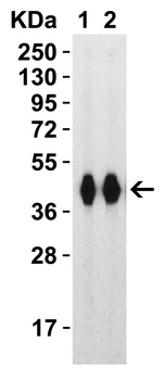 SARS-CoV-2 (COVID-19) Spike RBD Antibody