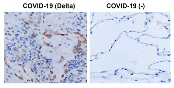 SARS-CoV-2 (COVID-19) Spike S1 Antibody