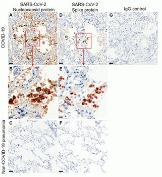 SARS-CoV-2 (COVID-19) Spike S1 Antibody