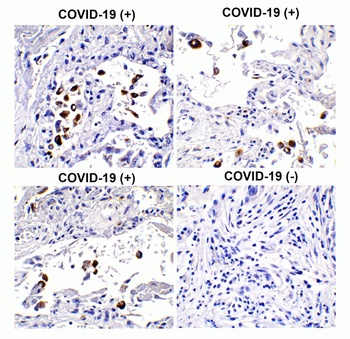 SARS-CoV-2 (COVID-19) Spike S1 Antibody