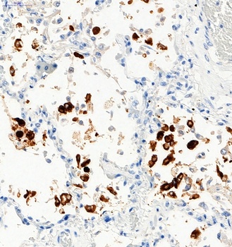 SARS-CoV-2 (COVID-19) Spike S1 Antibody