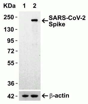 SARS-CoV-2 (COVID-19) Spike S1 Antibody