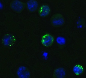 SARS-CoV-2 (COVID-19) Spike S1 Antibody