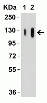 SARS-CoV-2 (COVID-19) Spike S1 Antibody