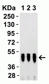 SARS-CoV-2 (COVID-19) Nucleocapsid Antibody