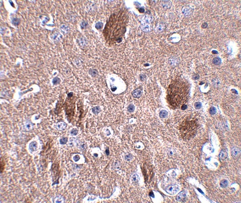 CDIP Antibody