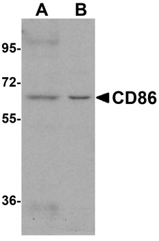 CD86 Antibody