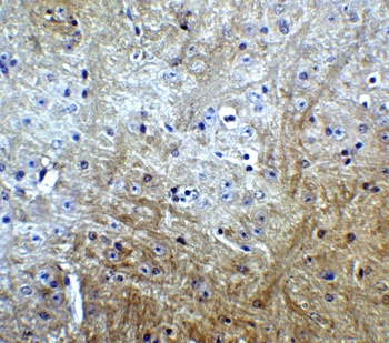 Slitrk1 Antibody
