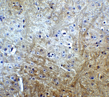 SLITRK1 Antibody