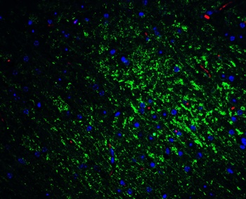 SLITRK1 Antibody