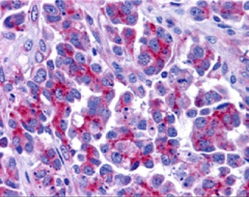 Smac Antibody