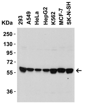 SPTLC2 Antibody