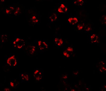 SPTLC2 Antibody