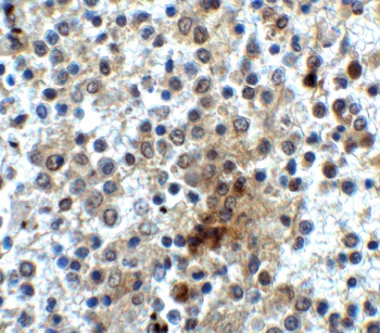 CD28 Antibody