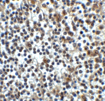 CD276 Antibody