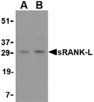 TNFSF11 Antibody