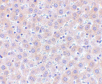 TNFSF11 Antibody