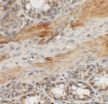 CCP110 Antibody