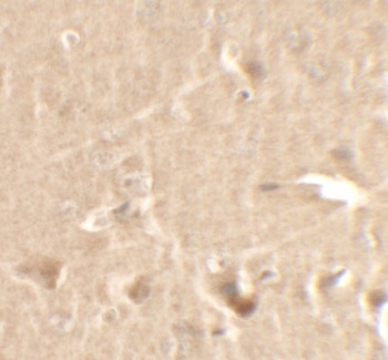 CCNT1 Antibody