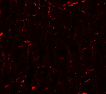 CCNT1 Antibody