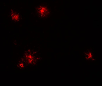 CCL2 Antibody