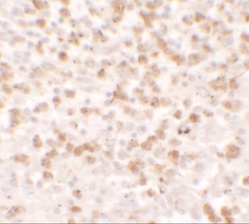 CCL17 Antibody