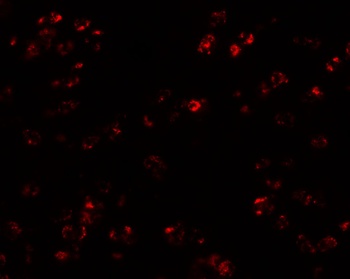 CCL17 Antibody