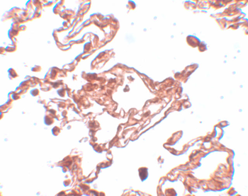 CCDC69 Antibody