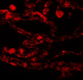 CCDC69 Antibody