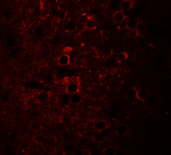 CCDC55 Antibody