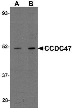 CCDC47 Antibody