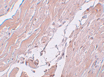 CCDC47 Antibody