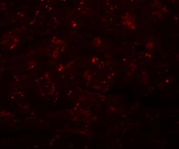 CCDC47 Antibody