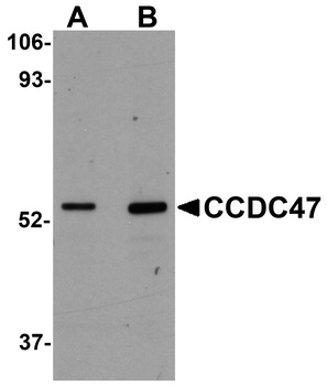CCDC47 Antibody