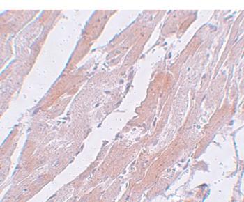 CCDC47 Antibody