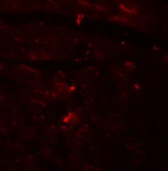 CCDC47 Antibody