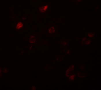 CCDC22 Antibody