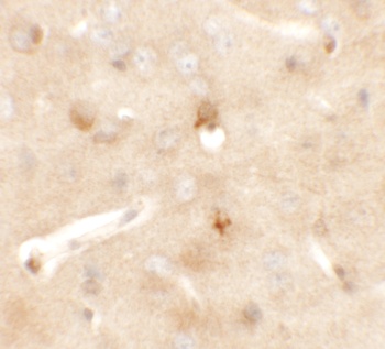 CCDC141 Antibody