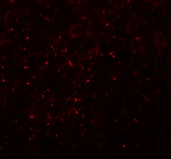 CCDC141 Antibody