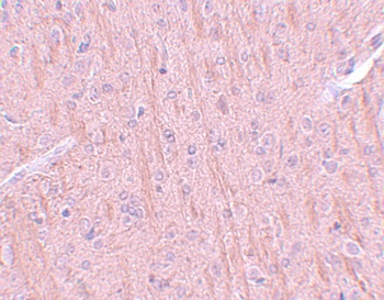 CCDC106 Antibody