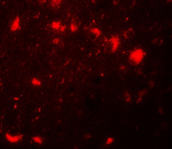 CBX4 Antibody