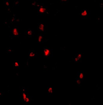 CBL Antibody