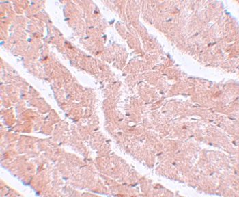 MTUS2 Antibody