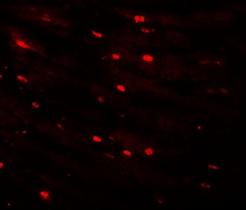 MTUS2 Antibody