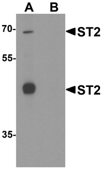 ST2 Antibody