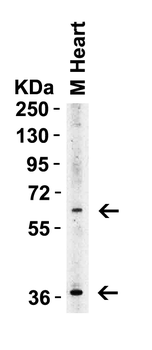 ST2 Antibody