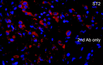 ST2 Antibody
