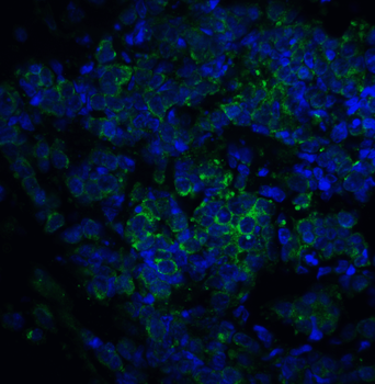 ST2 Antibody