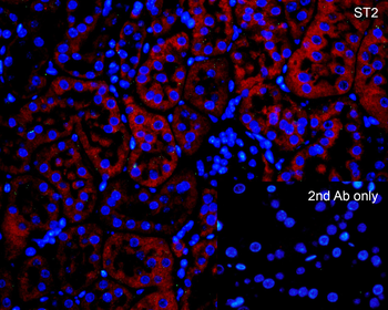 ST2 Antibody